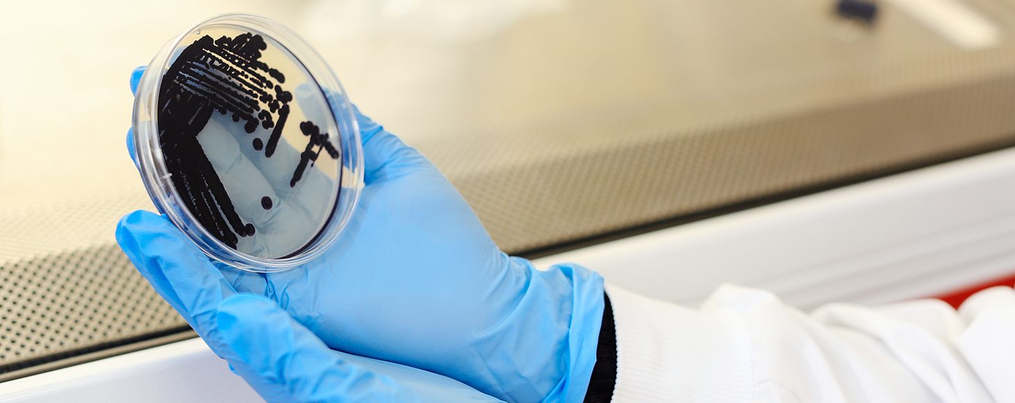 Petri dish with colour bacteria growing in a lab